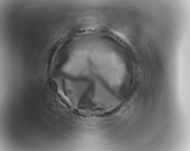 X0000088751399200706212106