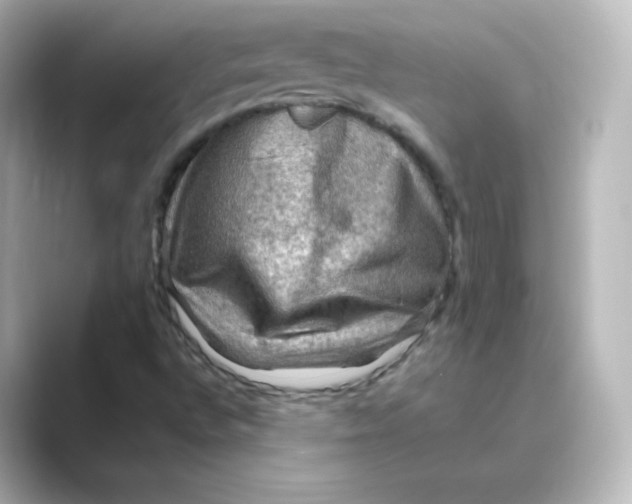 X0000088751496200706212105