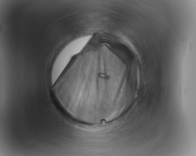 X0000088750019200706282214