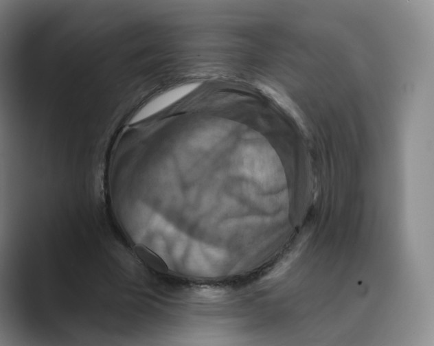 X0000088750585200706282207