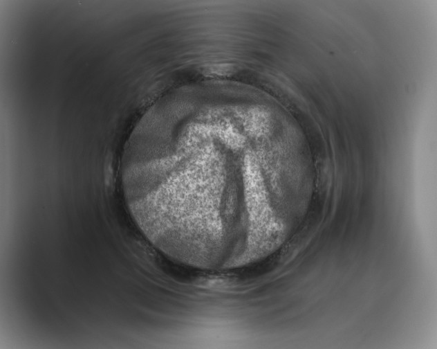 X0000088750655200706282206