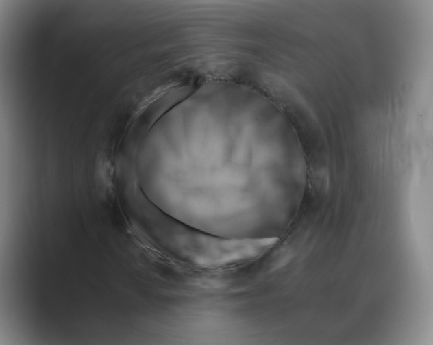 X0000088751010200706282201