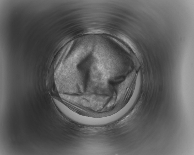 X0000088751193200706282159