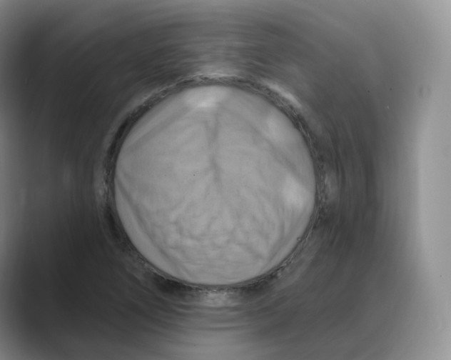 X0000088751266200706282158