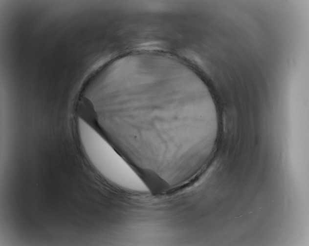 X0000088751405200706282155