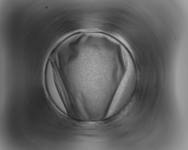 X0000088751485200706282155