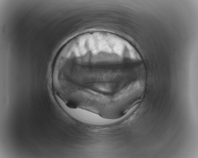 X0000088751522200706282155