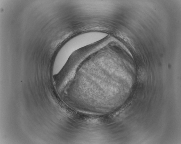 X0000088830358200707051428