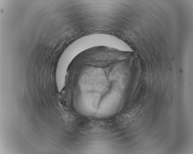 X0000088830818200707051420