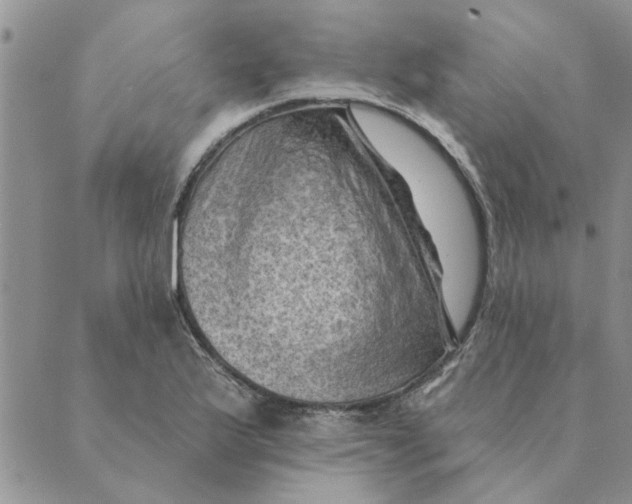 X0000088831175200707051415