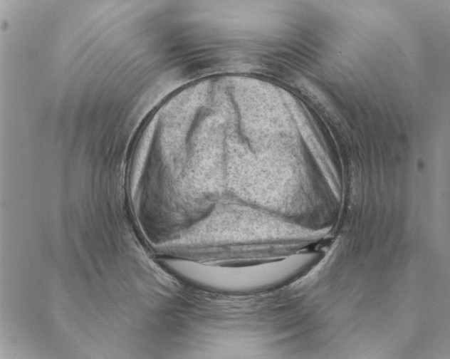 X0000088831178200707051414