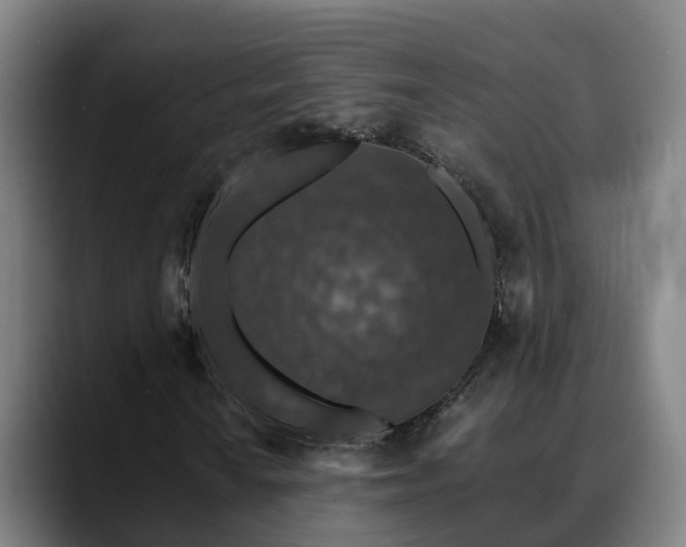 X0000088841010200706141535