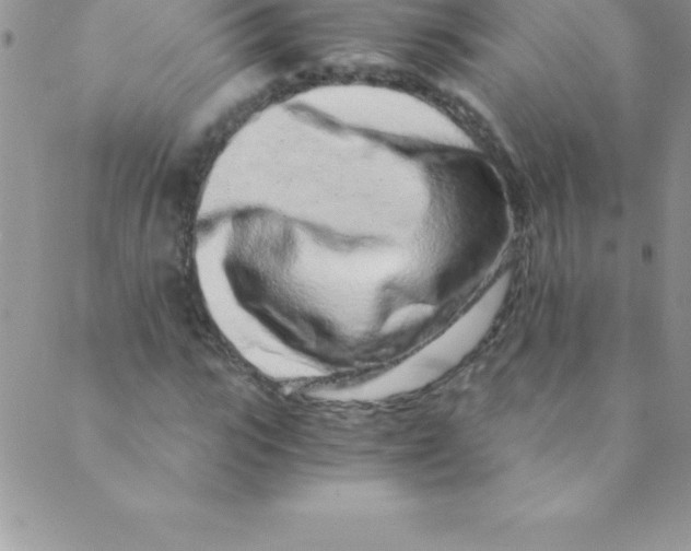 X0000088840919200707051444