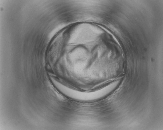 X0000088841230200707051439