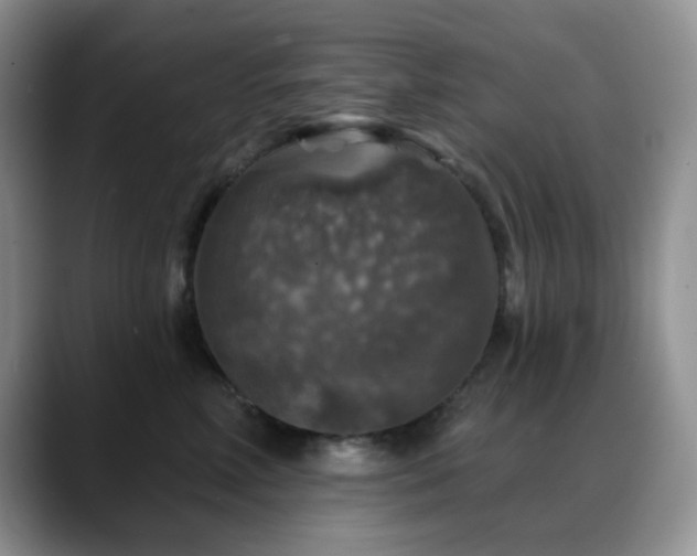 X0000088850618200706081136
