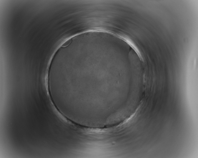 X0000088851100200706081130