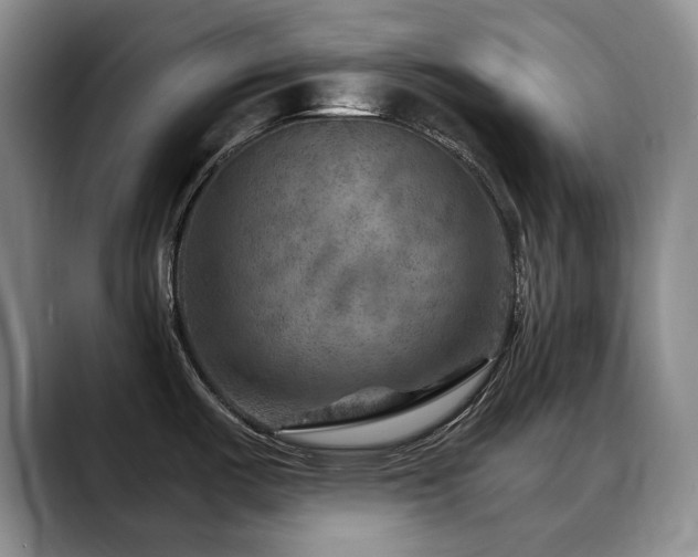 X0000088851487200706081126