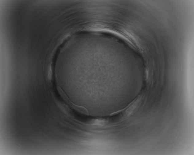 X0000088850158200706151723