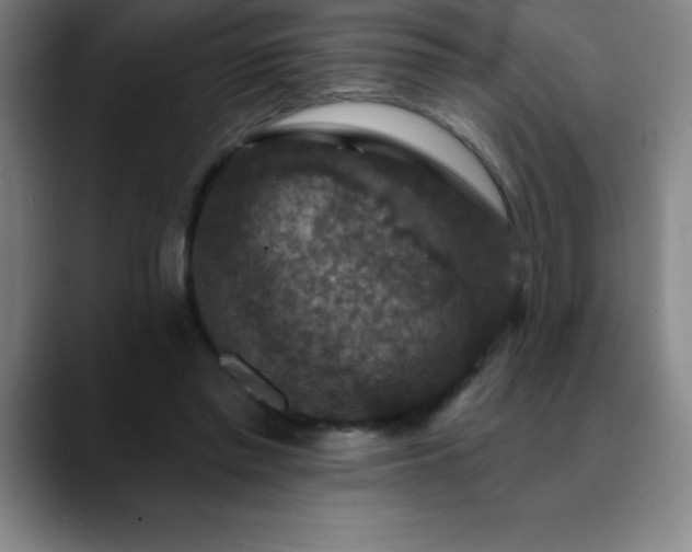 X0000088850397200706151721