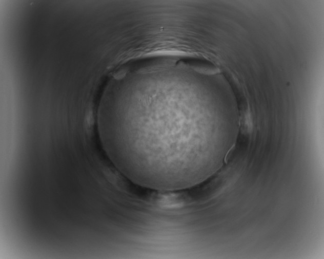 X0000088850472200706151720