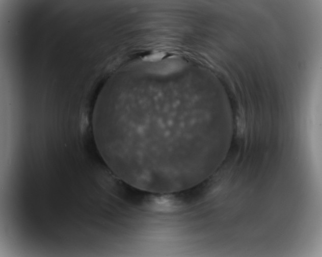 X0000088850618200706151718