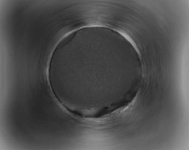 X0000088851197200706151711
