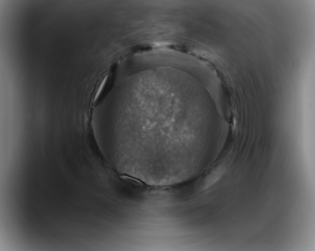 X0000088851300200706151710