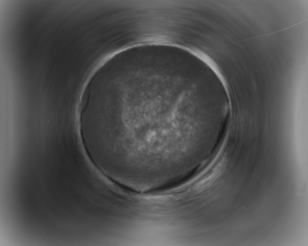 X0000088851389200706151709
