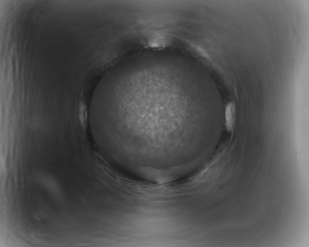 X0000088851443200706151708