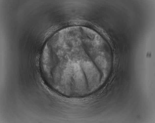 X0000088850010200706291505