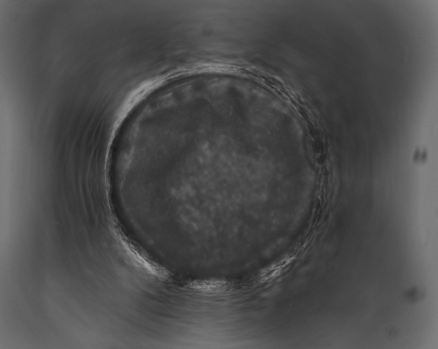 X0000088850104200706291504