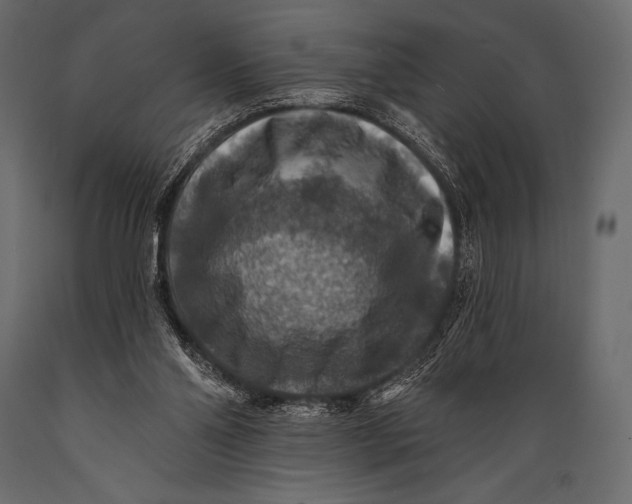 X0000088850110200706291504