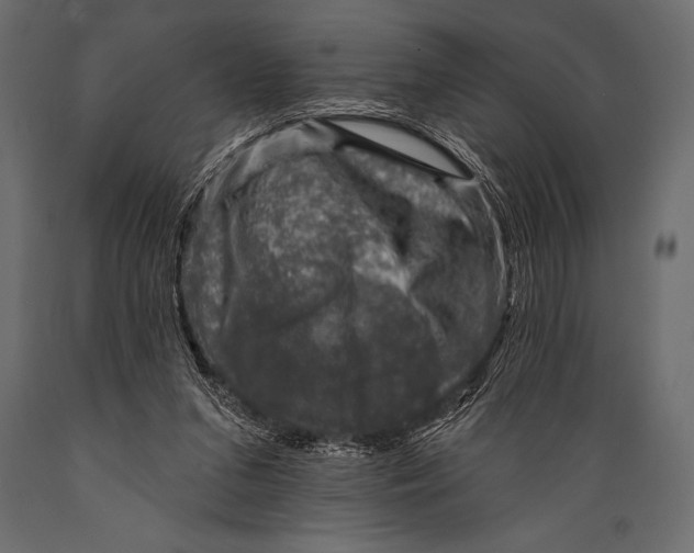 X0000088850207200706291503