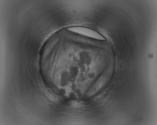 X0000088850346200706291500