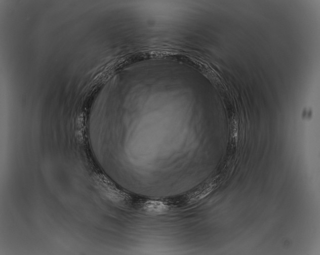 X0000088850519200706291458