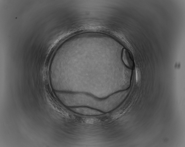 X0000088850579200706291457