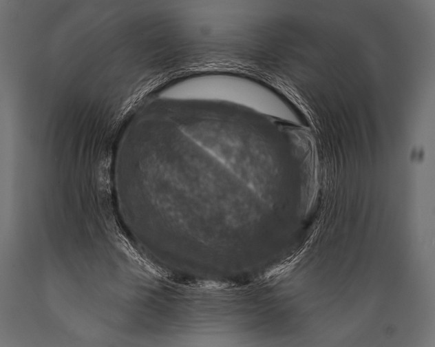 X0000088850585200706291457