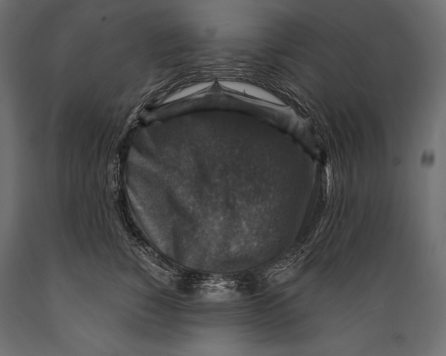 X0000088850760200706291455