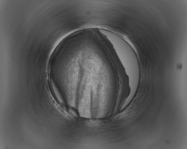 X0000088851148200706291449