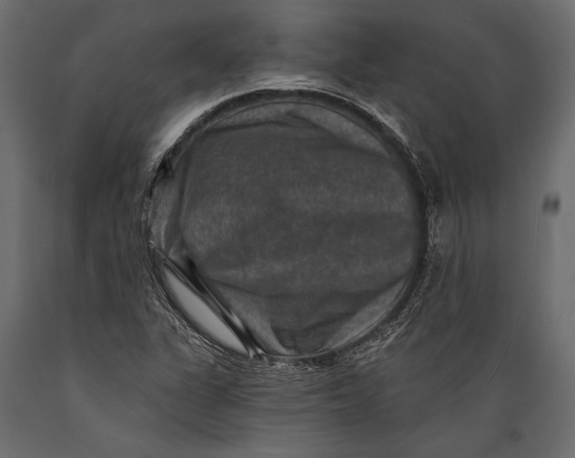 X0000088851311200706291446