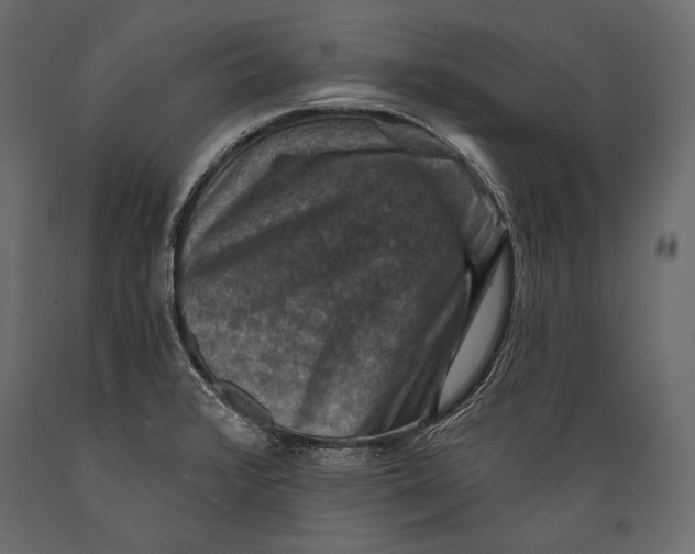 X0000088851376200706291445