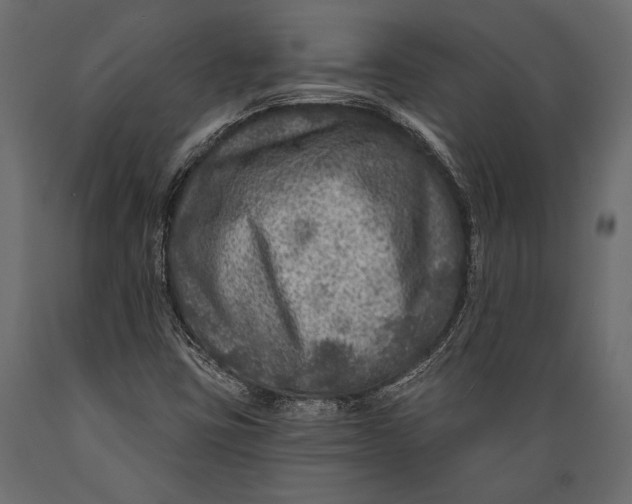 X0000088851403200706291445