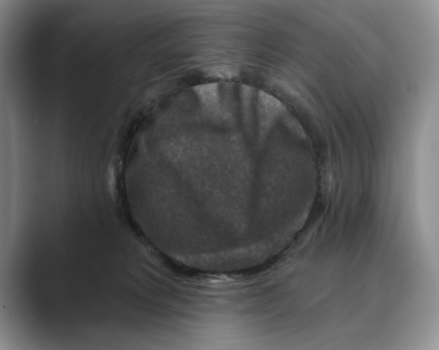 X0000088850229200707061038