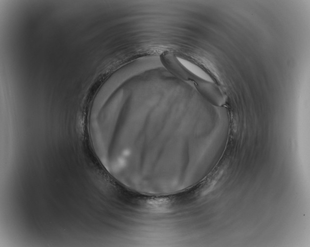 X0000088850357200707061037