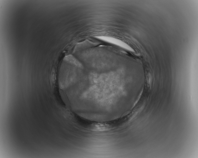 X0000088850372200707061037