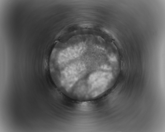 X0000088850382200707061037