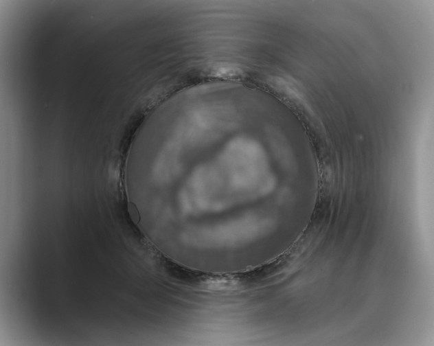 X0000088850415200707061036