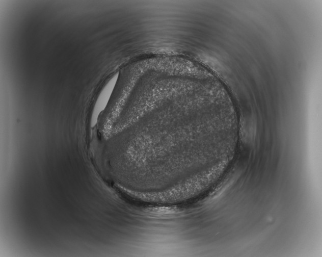 X0000088850449200707061036