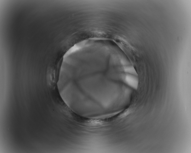 X0000088850528200707061035