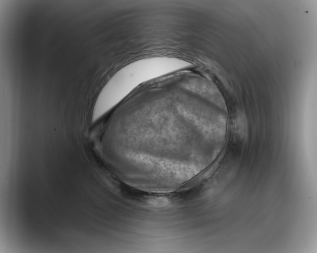 X0000088850572200707061035